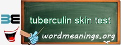 WordMeaning blackboard for tuberculin skin test